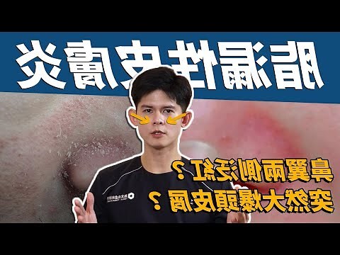 鼻子突然紅紅的