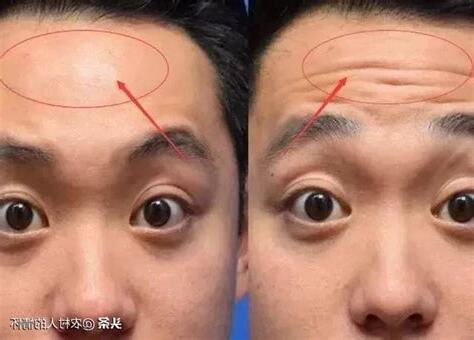 額頭代表什麼