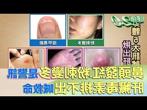 鼻頭紅