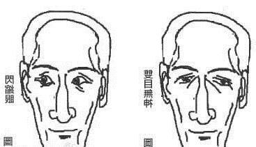 聳鼻