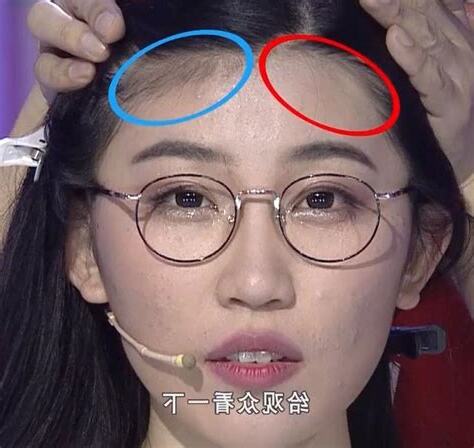 額頭低窄