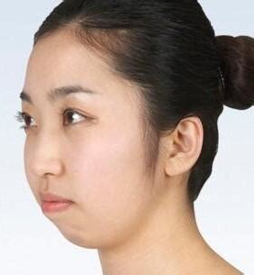 没有下巴的面相