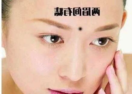 妨夫痣位置