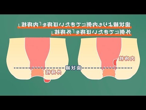 痔長毛