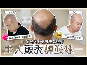 光頭頭頂