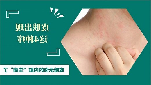 皮肤痒是什么原因