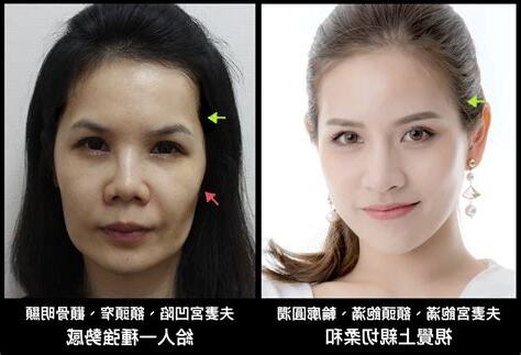 臉頰飽滿面相