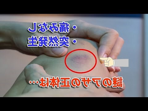 痣生成原因