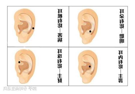 耳朵長痣