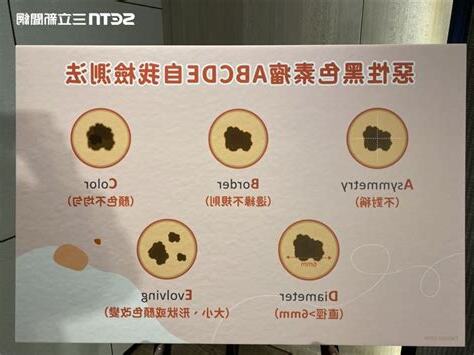 陰唇長痣