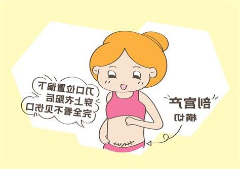 剖腹位置
