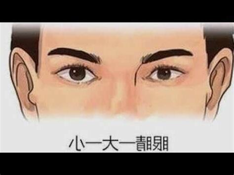 眼凹面相