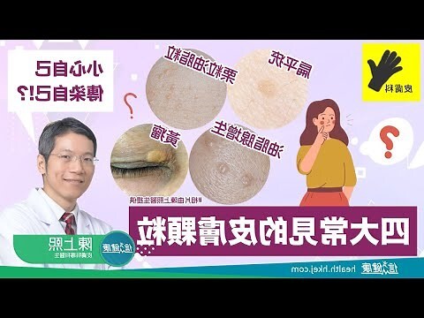 臉上長一根毛