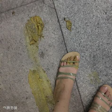 踩到狗大便