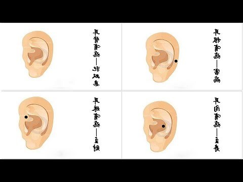 右耳上有痣