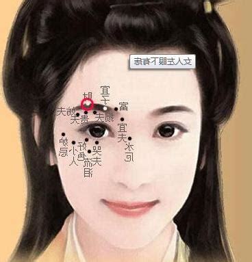 左眼下突然長痣