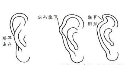 耳朵风水