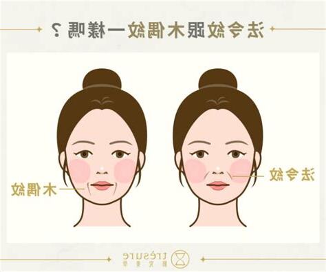 法令紋過嘴