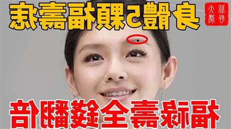 福祿痣