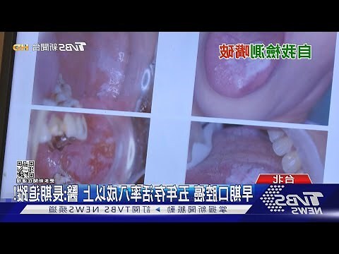 嘴巴圖片