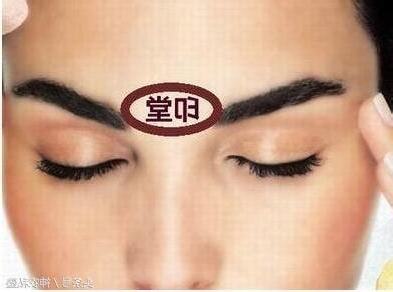 印堂發青