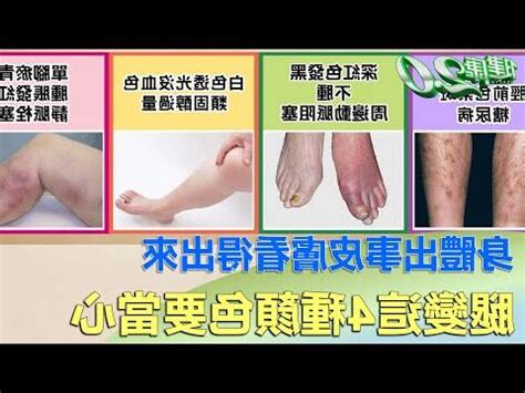 身體發黑
