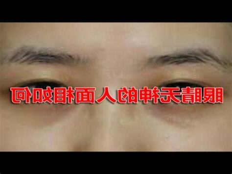 眼睛無神面相
