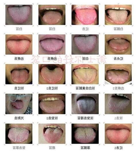舌顏色