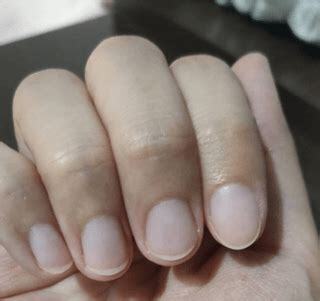 食指歪歪的