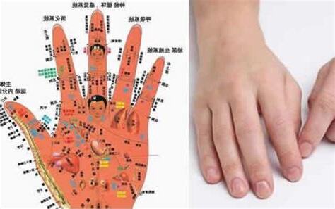 中指有痣