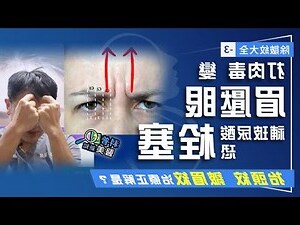 額頭上的皺紋