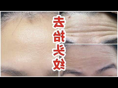 額頭有皺紋面相