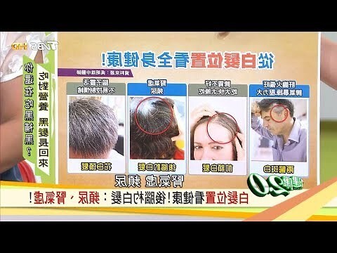 手上長一根白毛