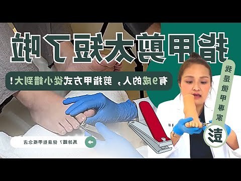 怎麼剪腳指甲
