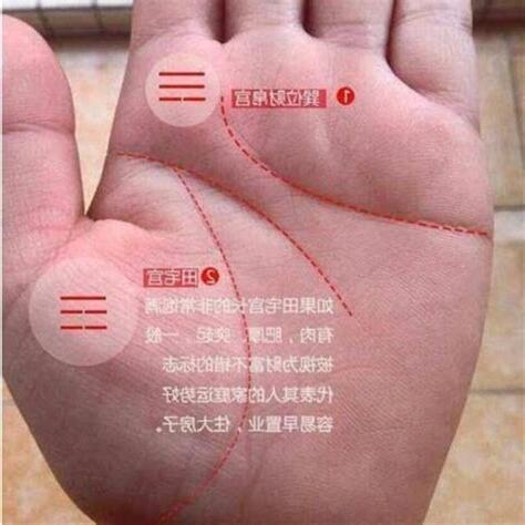 右手金星丘有痣