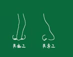 鼻有三彎
