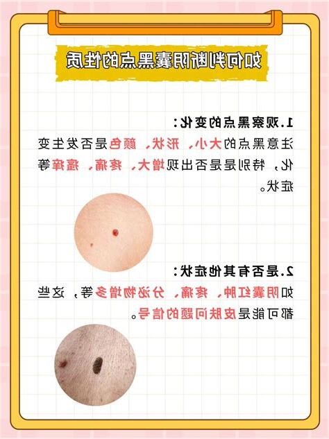 阴茎上有痣