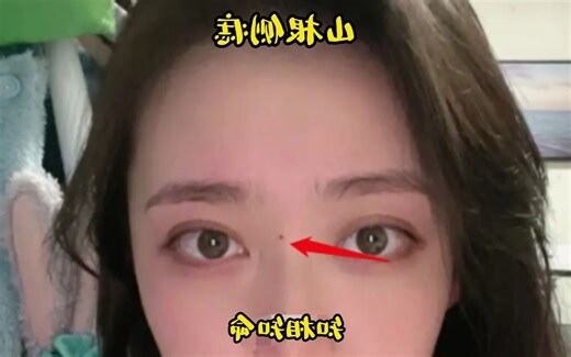 山根上有痣