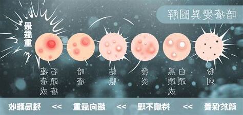 眉頭生石頭瘡