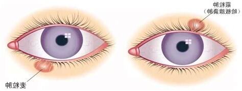 眼皮長痘痘代表什麼