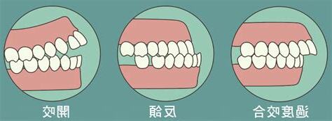 反頜意思