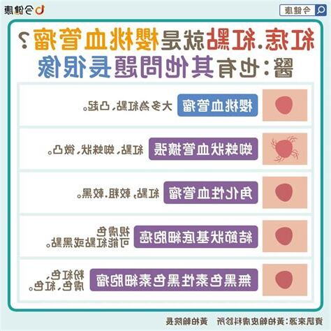 為什麼身上會有痣