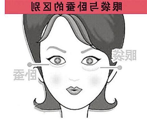 眼睛臥蠶面相