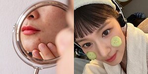 下巴有疤