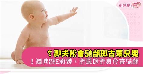 蒙古斑胎記