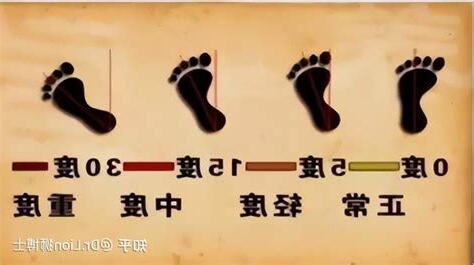 走路外八字