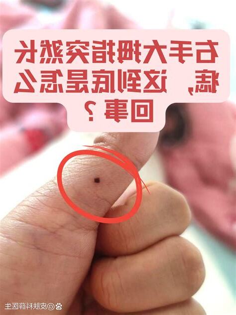 大拇指突然长痣