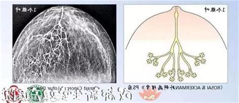 乳房有毛