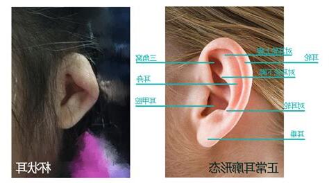 耳垂有珠