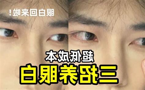 眼珠小眼白多